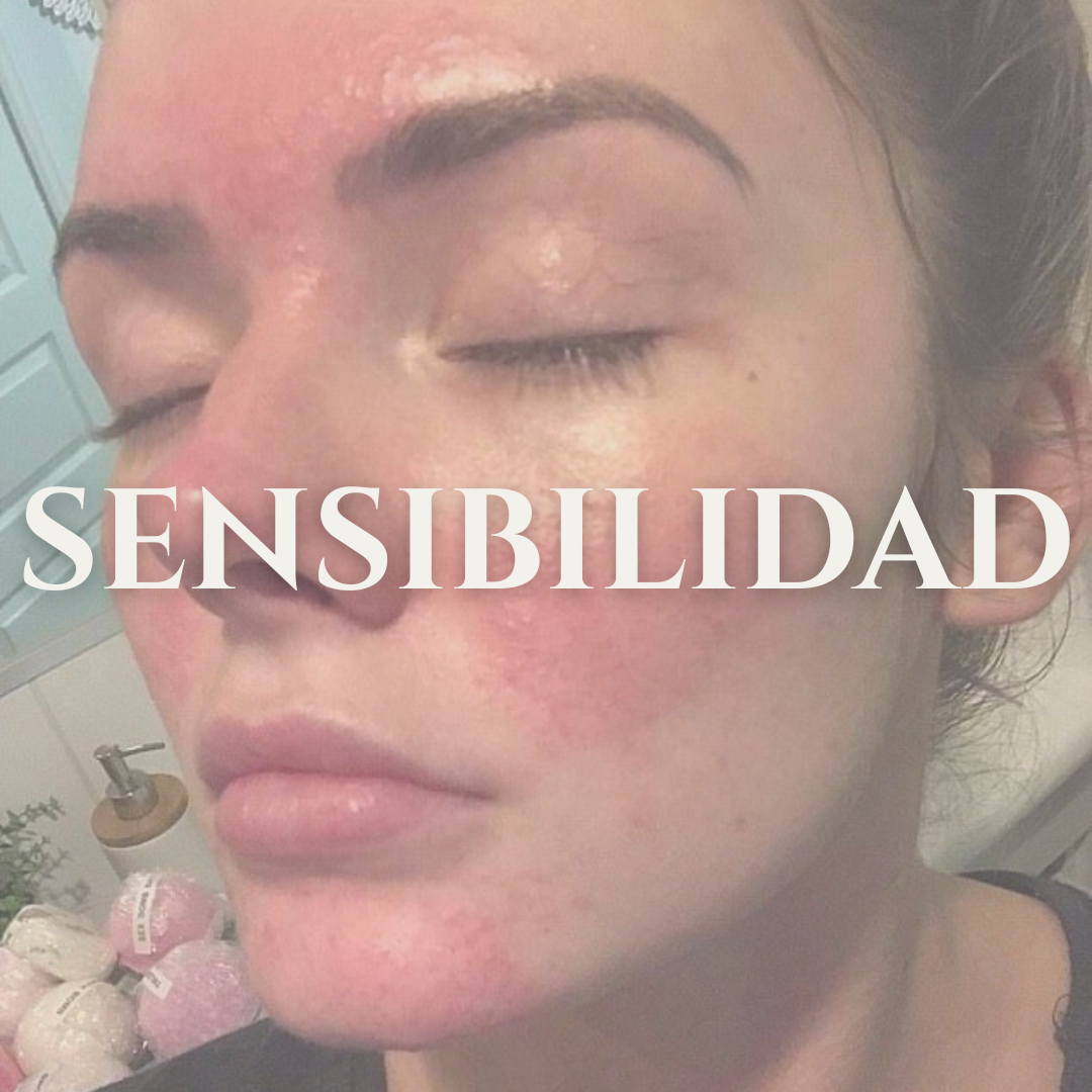 PIEL SENSIBLE