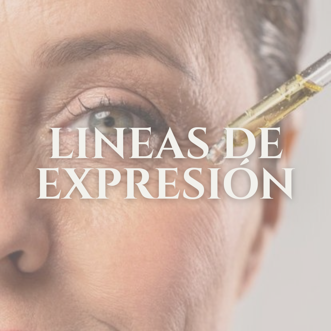 LINEAS DE EXPRESIÓN