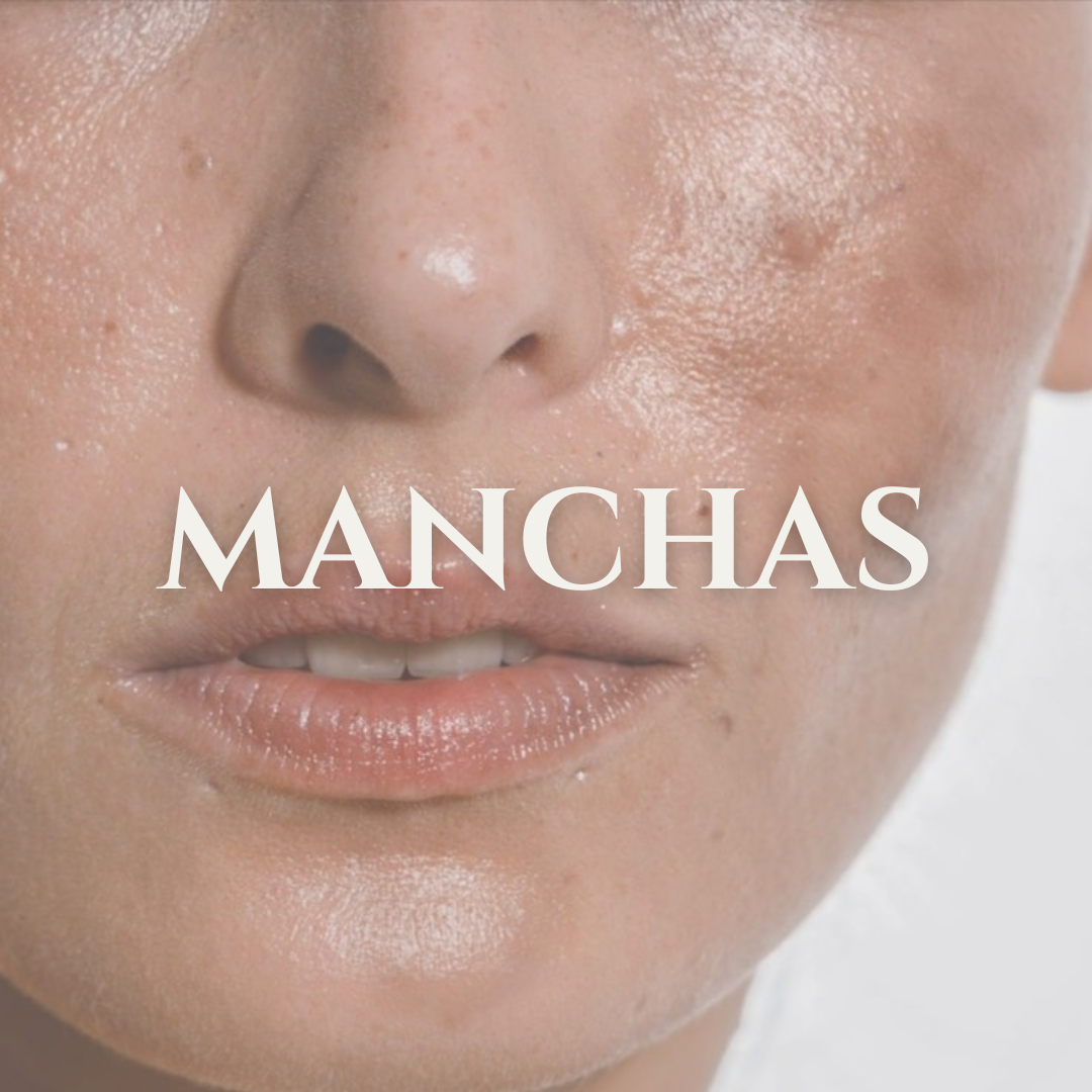 MANCHAS